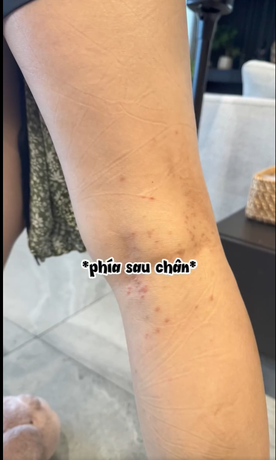 Mẹ bầu Ngô Thanh Vân gặp một tình trạng Mẹ bầu Ngô Thanh Vân gặp một tình trạng