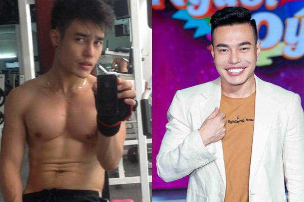 Sao nam Việt nghiện phẫu thuật thẩm mỹ: Từng cứ 10 ngày lại đi chỉnh sửa 1 lần, bị tụt sụn mũi khi đang chạy bộ - Ảnh 5.