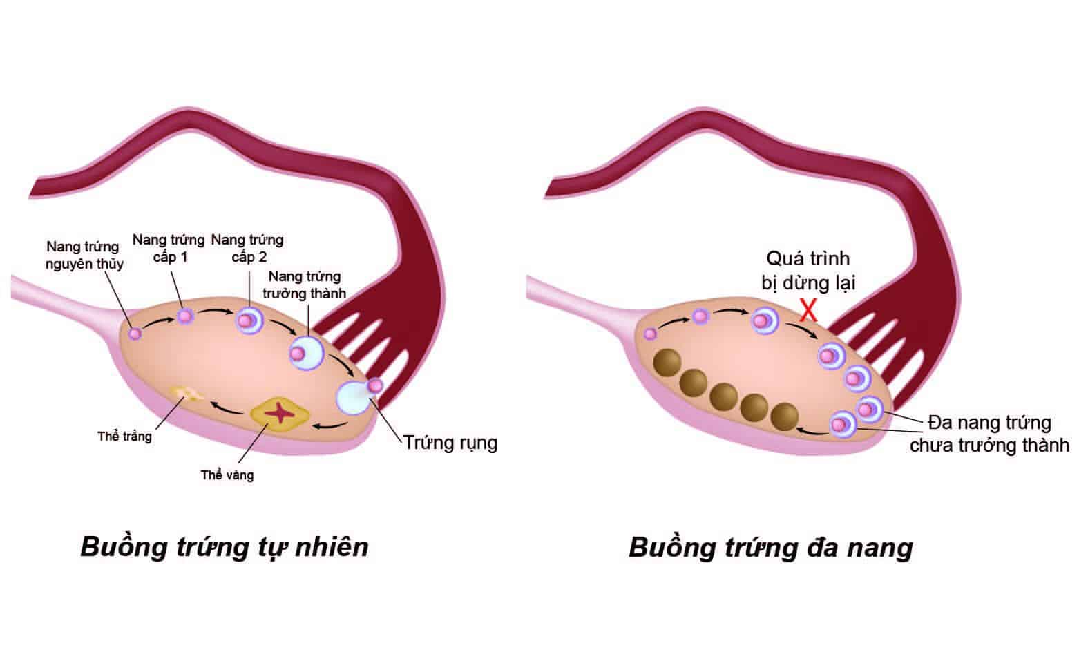 buong-trung-da-nang-17534357626451336450933-1753439509438-17534395095741720527221.jpg
