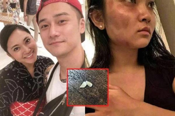 5 mỹ nam trên phim là soái ca ngôn tình, ngoài đời lại thẳng tay đánh bạn gái thừa sống thiếu chết- Ảnh 3. 5 mỹ nam trên phim là soái ca ngôn tình, ngoài đời lại thẳng tay đánh bạn gái thừa sống thiếu chết- Ảnh 3.