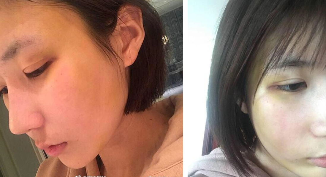 5 mỹ nam trên phim là soái ca ngôn tình, ngoài đời lại thẳng tay đánh bạn gái thừa sống thiếu chết- Ảnh 6. 5 mỹ nam trên phim là soái ca ngôn tình, ngoài đời lại thẳng tay đánh bạn gái thừa sống thiếu chết- Ảnh 6.
