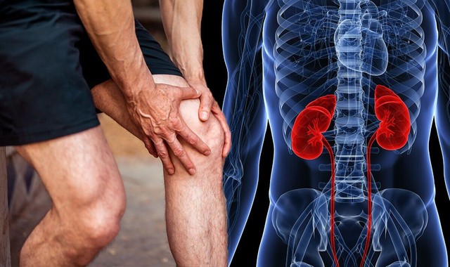 Khi thận suy hỏng, cơ thể xuất hiện 1 điểm bất thường ở chân: Tuyệt đối đừng chủ quan! - Ảnh 2.