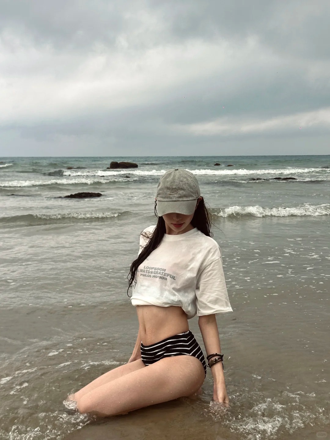 1 phương pháp thẩm mỹ mà các chị em cần lưu ý trước khi quyết định- Ảnh 7. 1 phương pháp thẩm mỹ mà các chị em cần lưu ý trước khi quyết định- Ảnh 7.