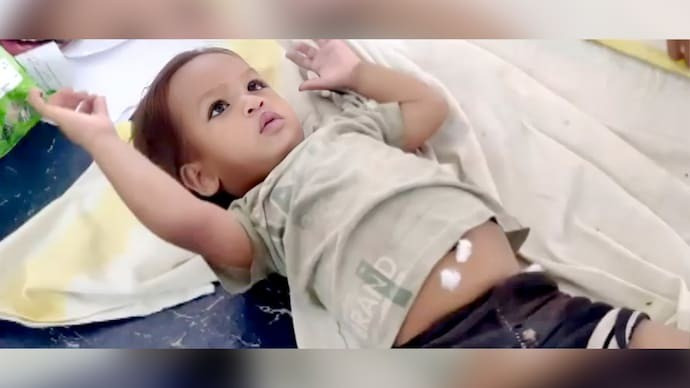 Hy hữu: Em bé hai tuổi cắn chết rắn hổ mang chúa - Ảnh 1. Hy hữu: Em bé hai tuổi cắn chết rắn hổ mang chúa - Ảnh 1.