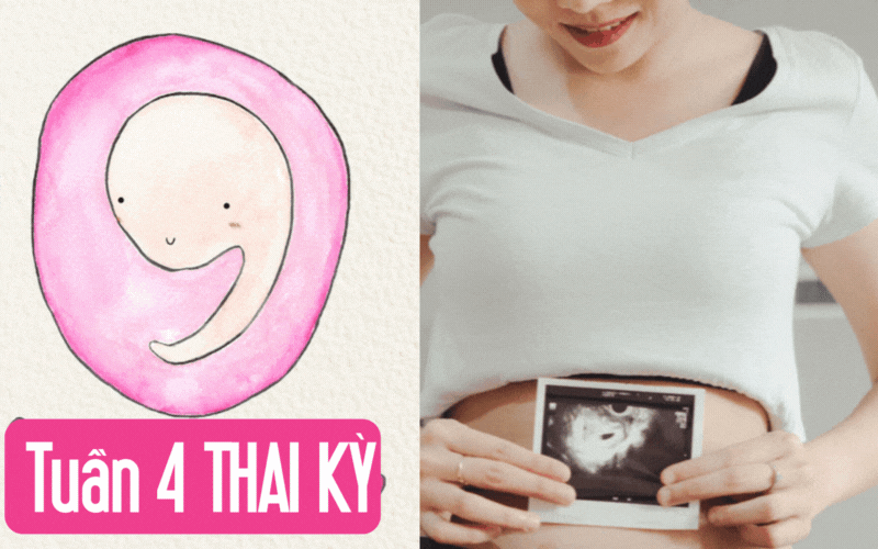Tuần thai thứ 4: Em bé đã bắt đầu hình thành, que thử thai lên “2 vạch”
