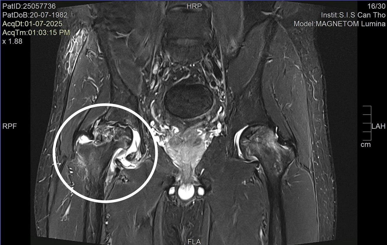 B&aacute;c sĩ ngoại quốc chẩn đo&aacute;n sai, Việt kiều về nước được điều trị khỏi bệnh - Ảnh 1.