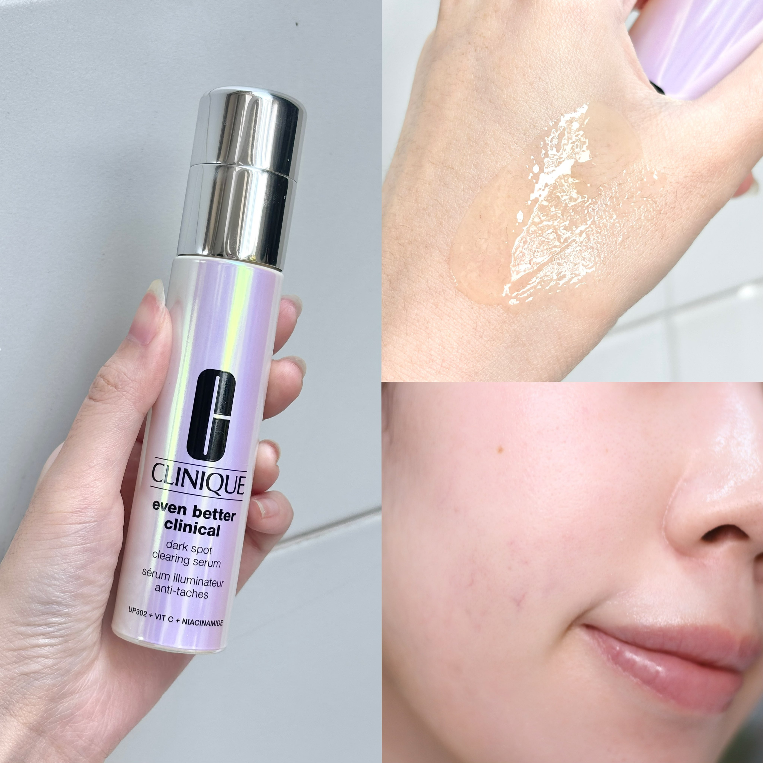 5 serum mờ thâm, giảm nám "đáng giá từng giọt" dành cho chị em ngoài 30 tuổi - Ảnh 4. 5 serum mờ thâm, giảm nám "đáng giá từng giọt" dành cho chị em ngoài 30 tuổi - Ảnh 4.