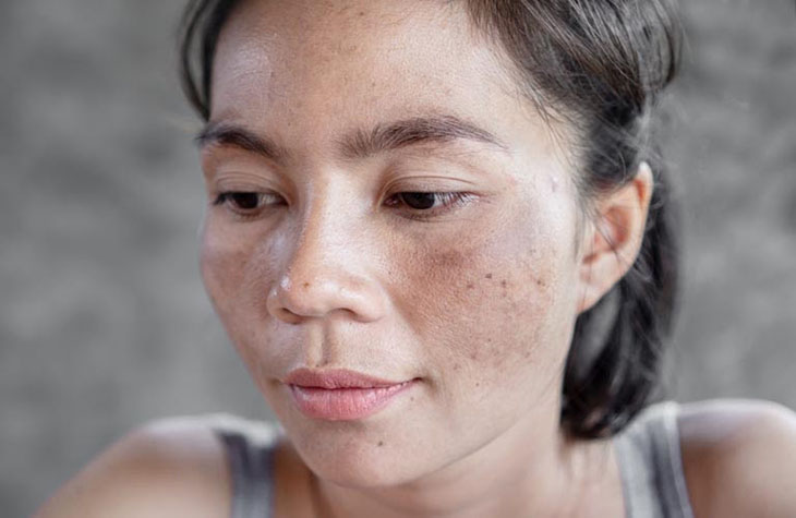 Loại lá trong vườn có tác dụng trị nám, làm sáng da nhanh chóng: Mùa hè có thể dùng để uống hoặc đắp mặt nạ- Ảnh 1. Loại lá trong vườn có tác dụng trị nám, làm sáng da nhanh chóng: Mùa hè có thể dùng để uống hoặc đắp mặt nạ- Ảnh 1.