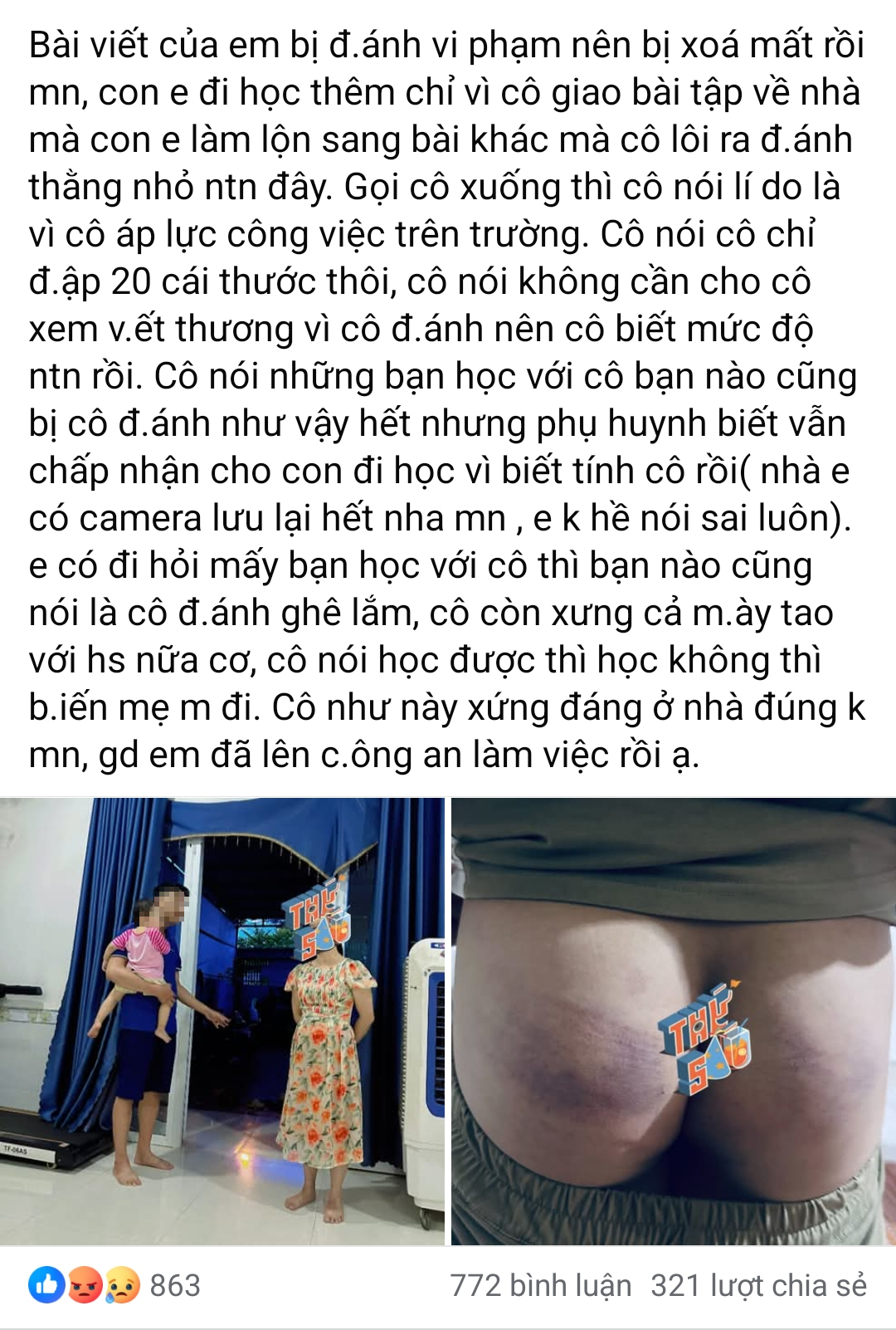 Công an xác minh thông tin cô giáo đánh học sinh bầm tím mông- Ảnh 1. Công an xác minh thông tin cô giáo đánh học sinh bầm tím mông- Ảnh 1.