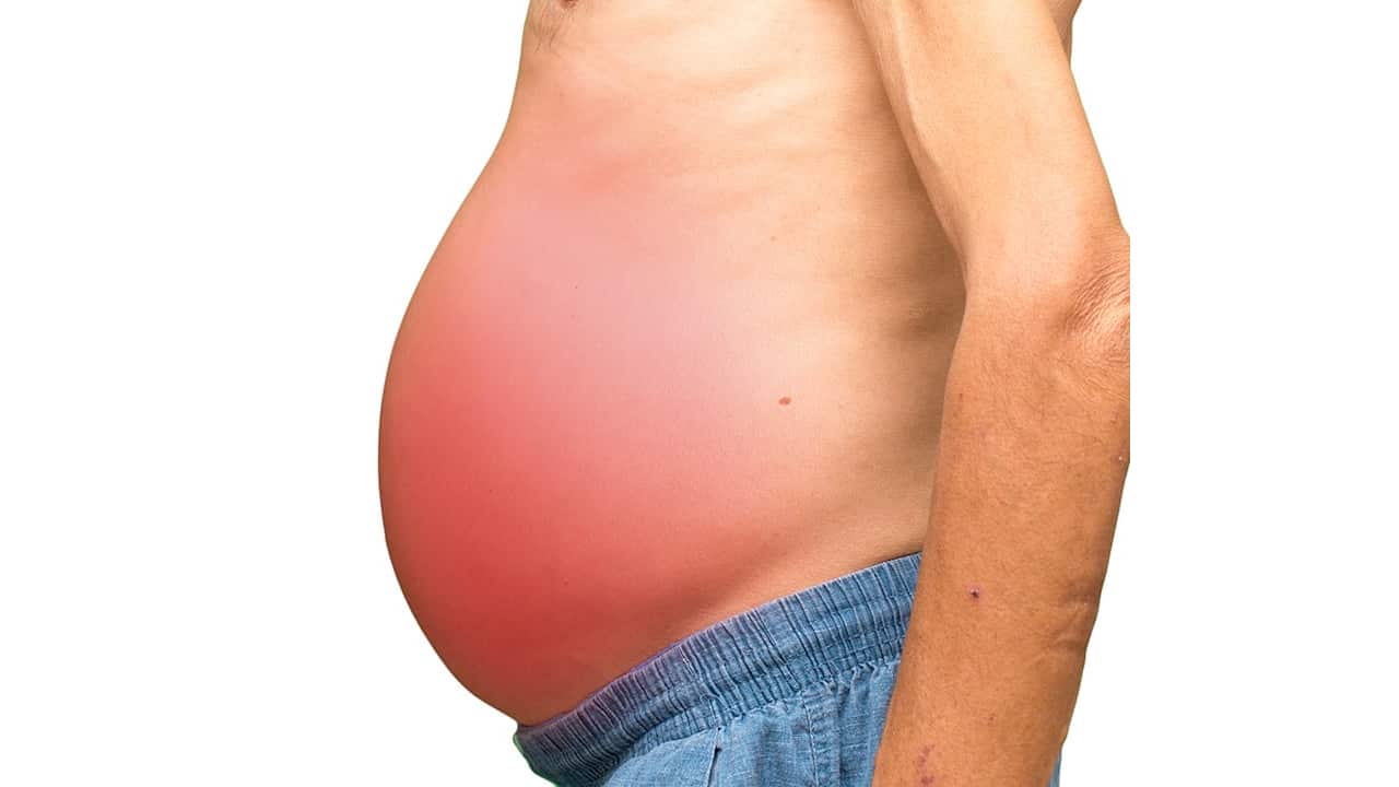 Khi gan suy hỏng nặng, cơ thể sẽ sưng ở 2 chỗ: Có 1 cũng nên đi khám ngay - Ảnh 2. Khi gan suy hỏng nặng, cơ thể sẽ sưng ở 2 chỗ: Có 1 cũng nên đi khám ngay - Ảnh 2.