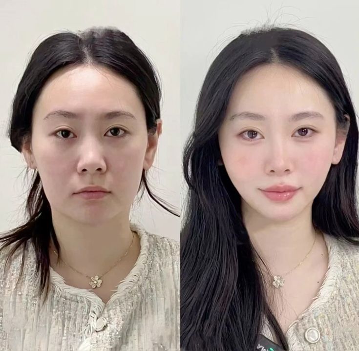 Cái giá của nhan sắc: Phẫu thuật hay chăm sóc tự nhiên? - Ảnh 2. Cái giá của nhan sắc: Phẫu thuật hay chăm sóc tự nhiên? - Ảnh 2.
