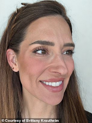 Tiêm botox vào một nửa khuôn mặt để xem ảnh hưởng thế nào đến vẻ bề ngoài: Nữ y tá Tiêm botox vào một nửa khuôn mặt để xem ảnh hưởng thế nào đến vẻ bề ngoài: Nữ y tá