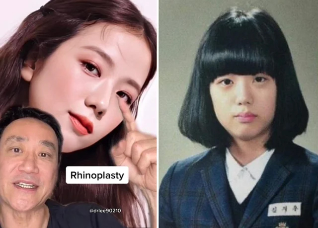BLACKPINK sở hữu visual gây sốt vươn tầm quốc tế: 1 quyết định trong quá khứ vô cùng đúng đắn để có nhan sắc bạc tỷ! - Ảnh 2. BLACKPINK sở hữu visual gây sốt vươn tầm quốc tế: 1 quyết định trong quá khứ vô cùng đúng đắn để có nhan sắc bạc tỷ! - Ảnh 2.