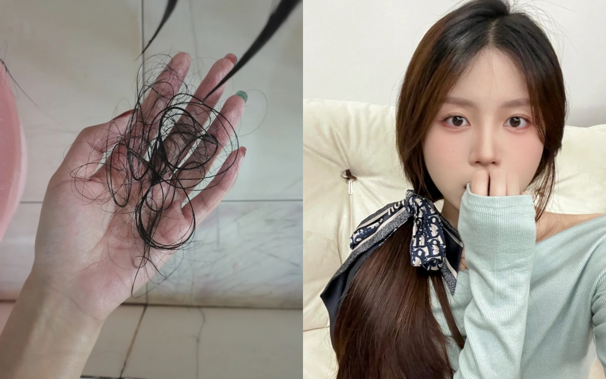 7 sai lầm khiến tóc rụng lả tả như lá mùa thu - Ảnh 1. 7 sai lầm khiến tóc rụng lả tả như lá mùa thu - Ảnh 1.