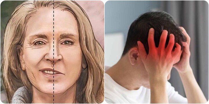 7 triệu chứng sắp bị đột quỵ cần lưu ý và xử lý ngay - Ảnh 2. 7 triệu chứng sắp bị đột quỵ cần lưu ý và xử lý ngay - Ảnh 2.