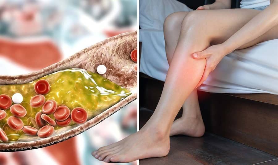 Sáng thức dậy mà gặp 6 dấu hiệu này ở đầu, coi chừng đột quỵ “đang tìm đến” bạn- Ảnh 2. Sáng thức dậy mà gặp 6 dấu hiệu này ở đầu, coi chừng đột quỵ “đang tìm đến” bạn- Ảnh 2.