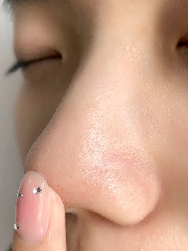 Thay đổi cách rửa mặt, làn da của tôi bất ngờ &quot;đẹp lên trông thấy&quot; - Ảnh 6.