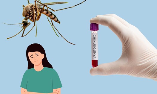 Chikungunya bùng phát ở nhiều nước, Bộ Y tế đưa ra khuyến cáo cho người dân phòng dịch Chikungunya- Ảnh 1.