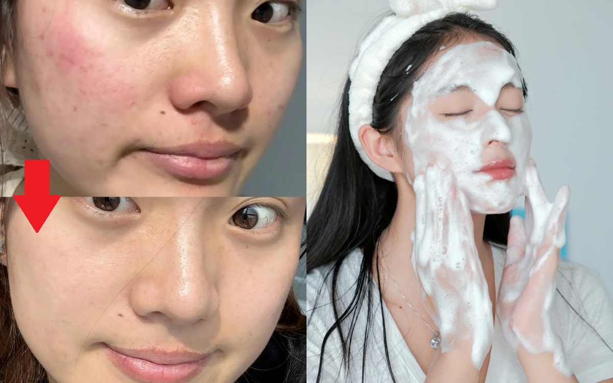 Thay đổi cách rửa mặt, làn da của tôi bất ngờ &quot;đẹp lên trông thấy&quot; - Ảnh 1.