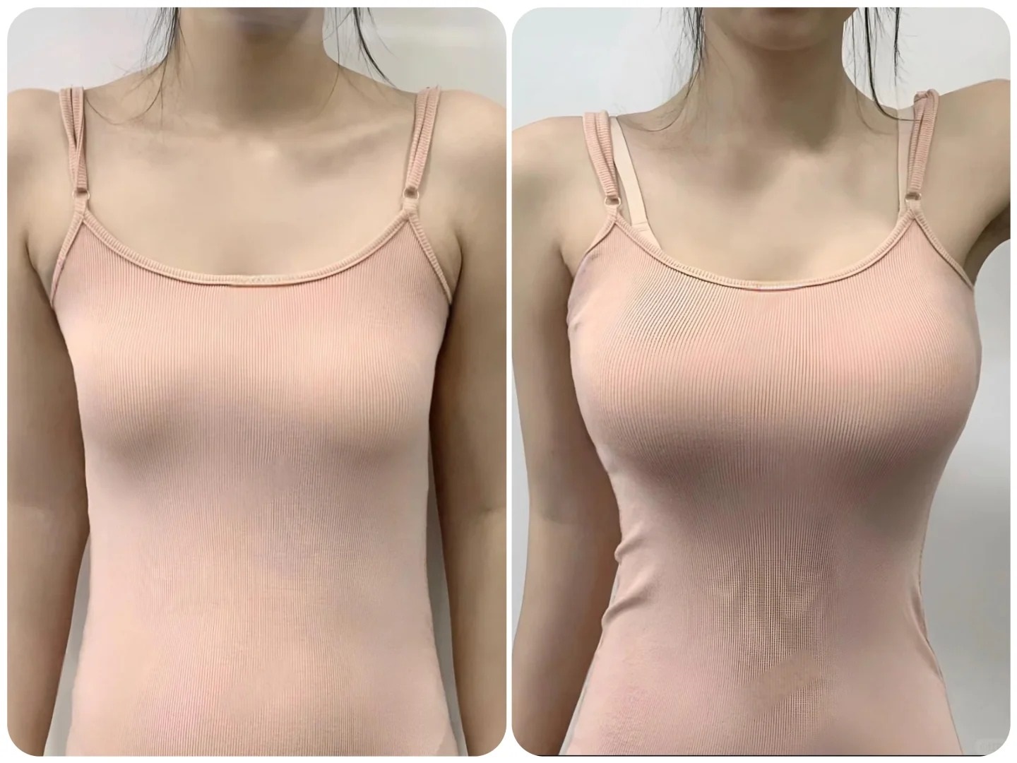Bác sĩ cảnh báo: Những rủi ro khi nâng ngực sai kỹ thuật - Ảnh 2.