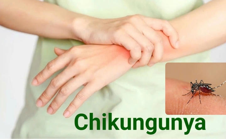 chikungunya-1-15274072-1755051102713-17550511029321925615909.jpg