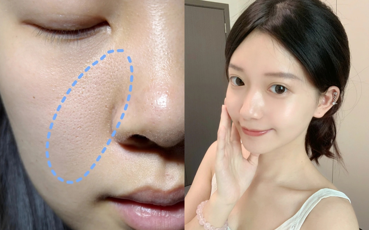 Lỗ chân lông nhỏ đi thấy rõ từ khi tôi đắp loại mặt nạ này mỗi tuần - Ảnh 1.