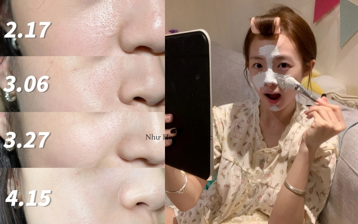 Lỗ chân lông nhỏ đi thấy rõ từ khi tôi đắp loại mặt nạ này mỗi tuần - Ảnh 2.