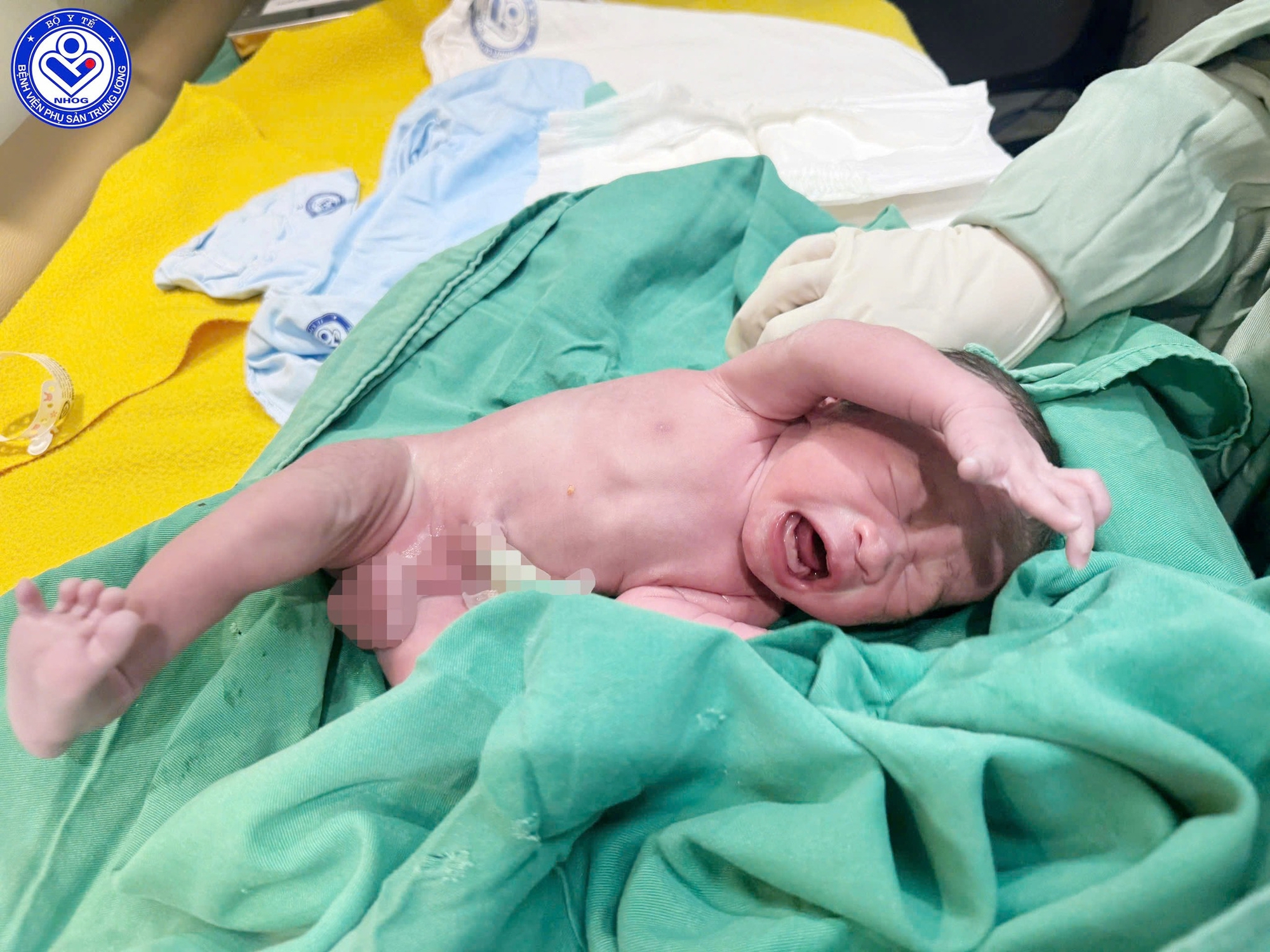Kỳ tích: Bé trai 1,9 kg chào đời khỏe mạnh từ mẹ mắc ung thư cổ tử cung giai đoạn muộn - Ảnh 2.