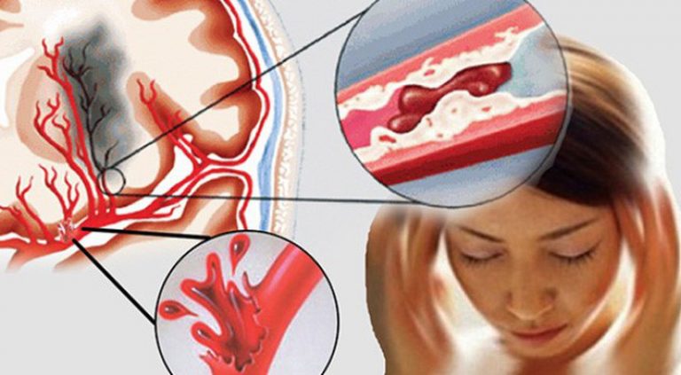 Nữ MC đột ngột qua đời ở tuổi 27: Cảnh báo thói quen sống âm thầm 