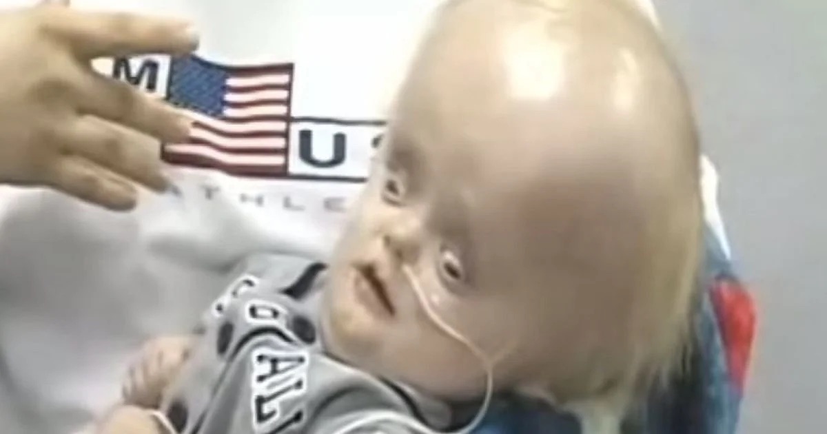 boy-born-without-brain-trevor-judge-waltrip-17551469032161566883918-1755167071073-17551670711441340875977.jpg