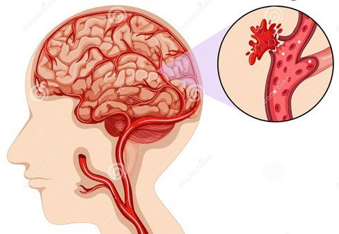 Nữ MC đột ngột qua đời ở tuổi 27: Cảnh báo thói quen sống âm thầm 