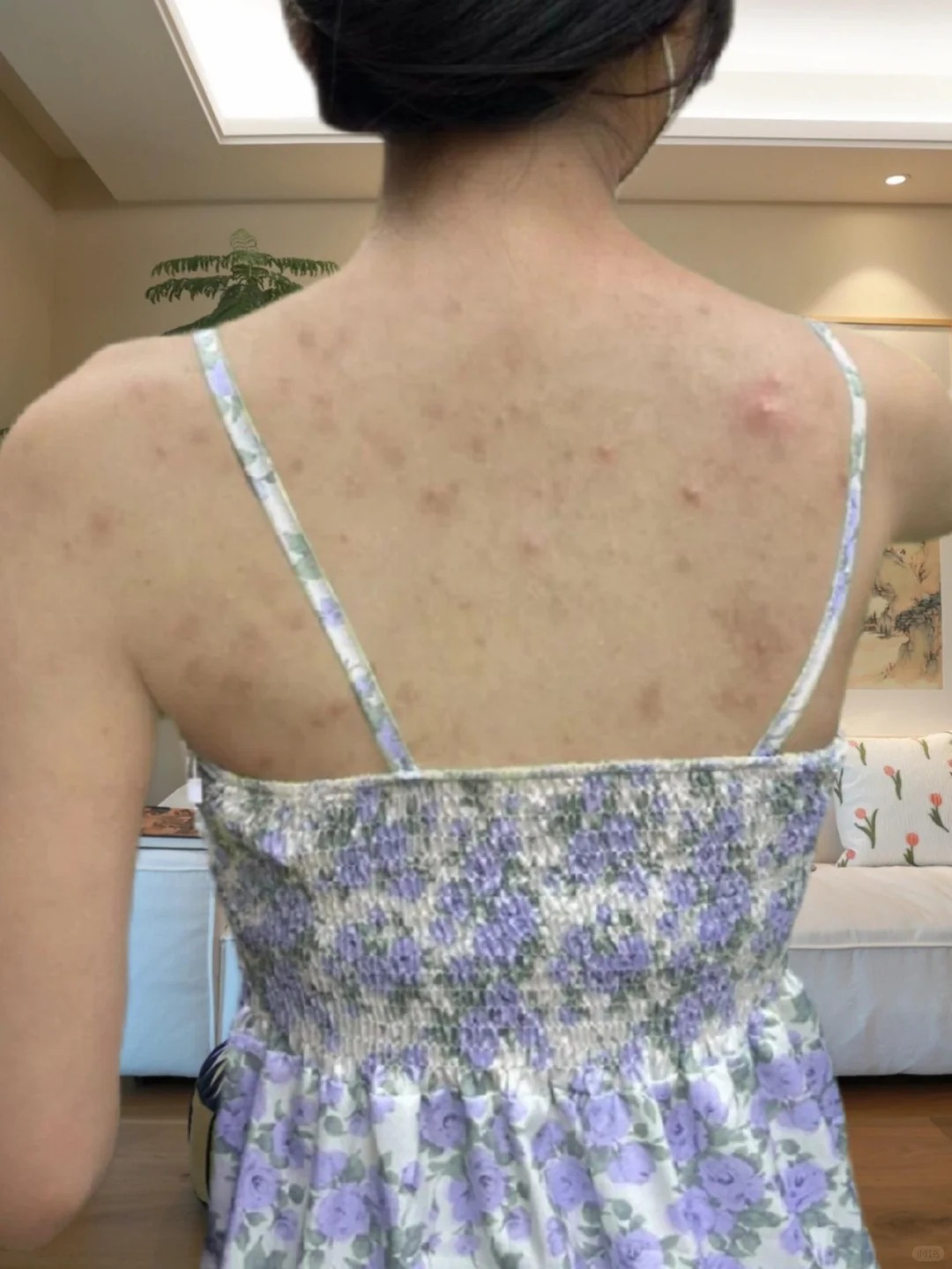 Từ mụn lưng sần sùi, tôi đã thay đổi hoàn toàn nhờ món đồ rẻ tiền - Ảnh 2.