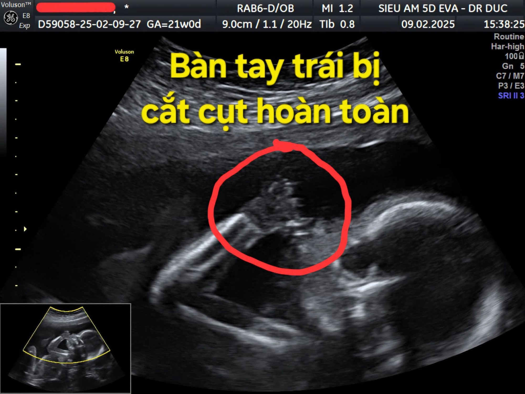 hoi-chung-dai-soi-oi-2-1755246590826573447743-1755249028733-17552490288292035232365.jpg