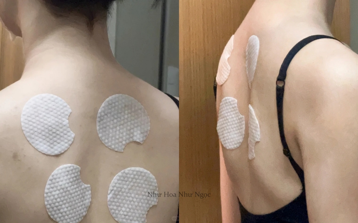 Từ mụn lưng sần sùi, tôi đã thay đổi hoàn toàn nhờ món đồ rẻ tiền - Ảnh 3.
