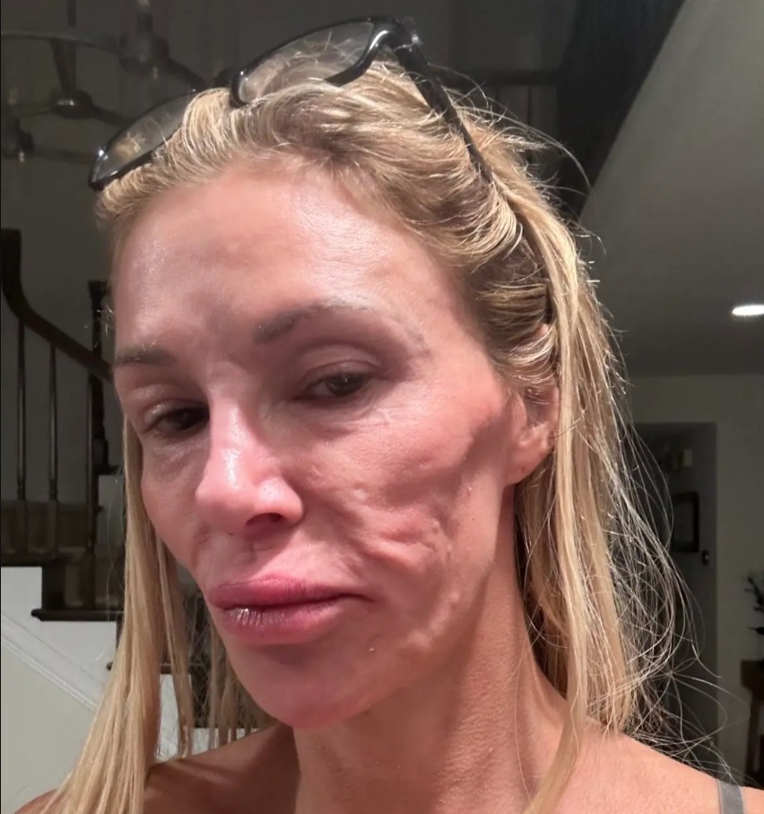 brandi-glanville-reveals-whoppin-1-17553458294281677213058-1755394672373-1755394672603232229075.jpg
