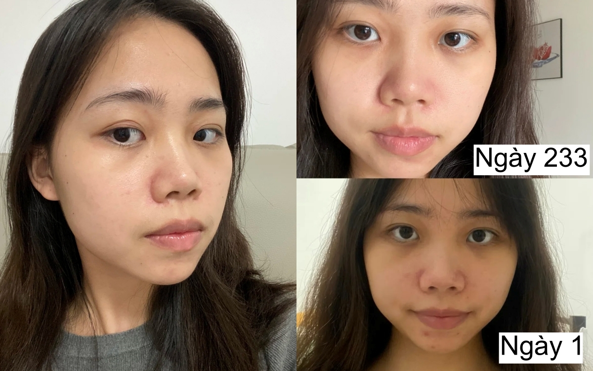 7 tháng tự dưỡng trắng da tại nhà, cô nàng nhận kết quả không thể mỹ mãn hơn - Ảnh 1. 7 tháng tự dưỡng trắng da tại nhà, cô nàng nhận kết quả không thể mỹ mãn hơn - Ảnh 1.