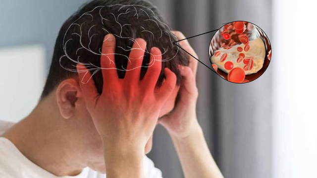 dot-quy-co-xu-huong-gia-tang-o-nguoi-tre-17554971784171324174938-1755526688299-1755526688432875786815.png