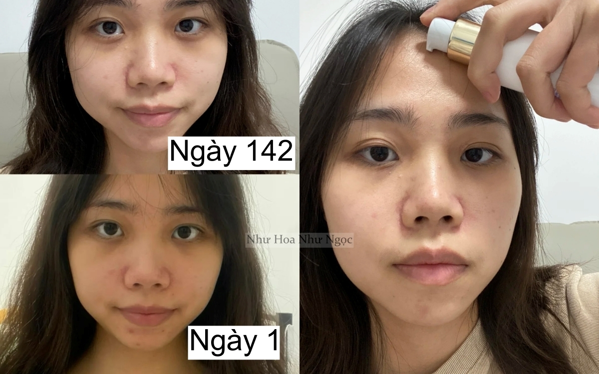 7 tháng tự dưỡng trắng da tại nhà, cô nàng nhận kết quả không thể mỹ mãn hơn - Ảnh 2. 7 tháng tự dưỡng trắng da tại nhà, cô nàng nhận kết quả không thể mỹ mãn hơn - Ảnh 2.