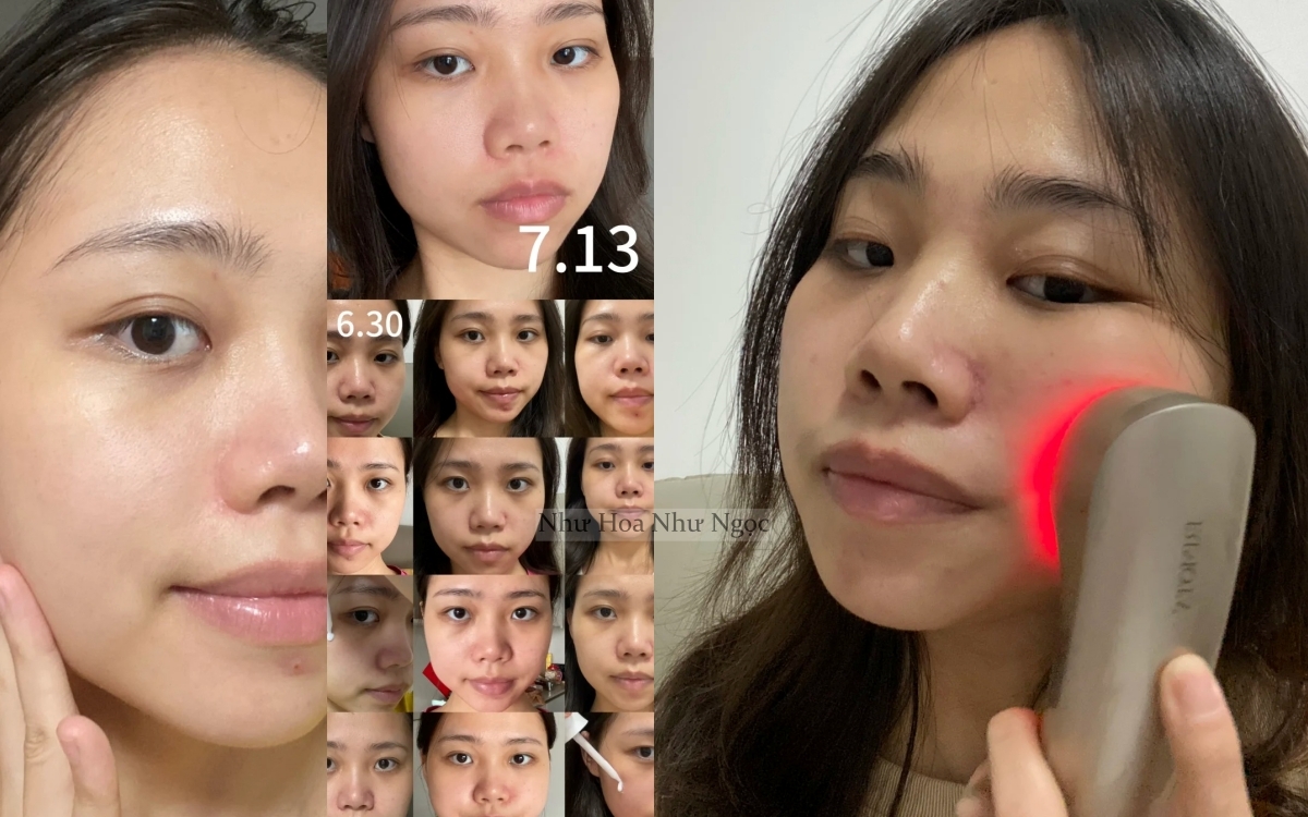 7 tháng tự dưỡng trắng da tại nhà, cô nàng nhận kết quả không thể mỹ mãn hơn - Ảnh 3. 7 tháng tự dưỡng trắng da tại nhà, cô nàng nhận kết quả không thể mỹ mãn hơn - Ảnh 3.