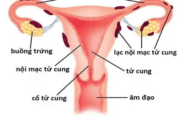Không ngại đăng bức ảnh của mình, nữ diễn viên 32 tuổi cảnh báo về căn bệnh của phụ nữ, có người phải 10 lần đi khám mới phát hiện ra- Ảnh 4.