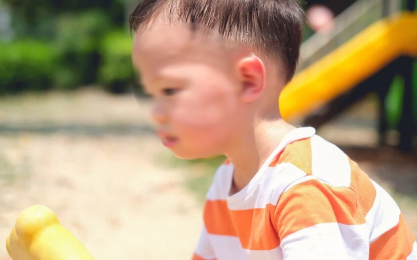 Cảnh báo nguy cơ say nắng ở trẻ nhỏ trong mùa hè: 5 bước sơ cứu khẩn cấp cha mẹ cần biết