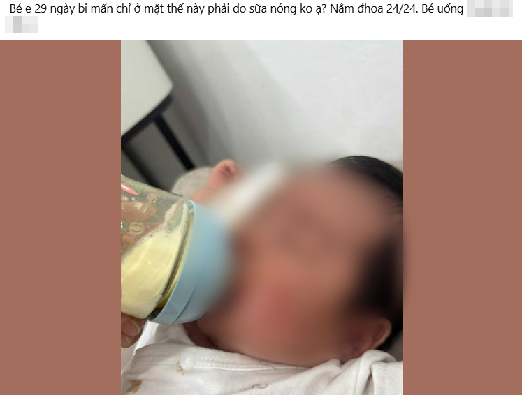 sua-cong-thuc-1-17556760051222095782494-1755680109193-17556801094531870411539.jpg