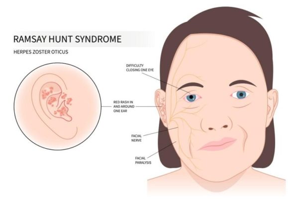 9 thực phẩm rút ngắn tuổi thọ được chuyên gia dinh dưỡng cảnh báo- Ảnh 2. 9 thực phẩm rút ngắn tuổi thọ được chuyên gia dinh dưỡng cảnh báo- Ảnh 2.