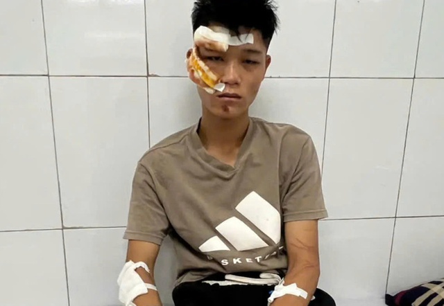 "Quái xế" khóc và khai về việc đi vào đường cấm, tông chiến sĩ cảnh sát cơ động - Ảnh 1. "Quái xế" khóc và khai về việc đi vào đường cấm, tông chiến sĩ cảnh sát cơ động - Ảnh 1.