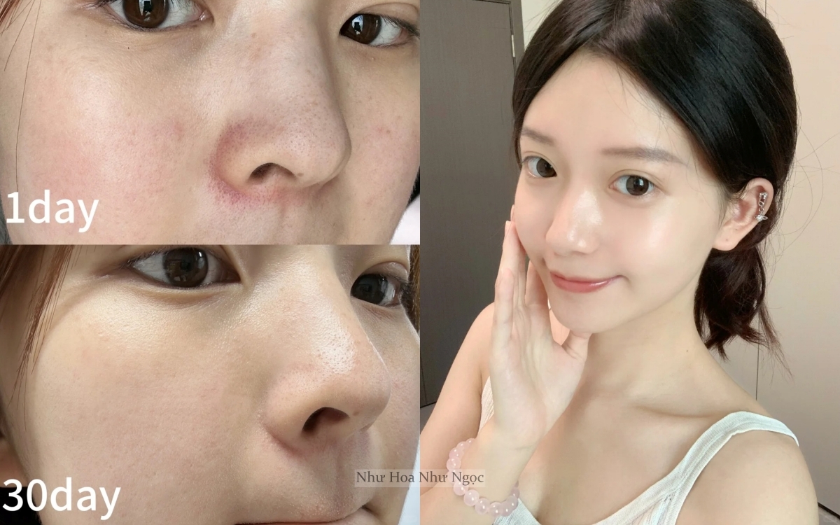 Không cần da “trắng sứ”, chỉ cần dưỡng đúng cách để da sáng mịn từ bên trong - Ảnh 1.
