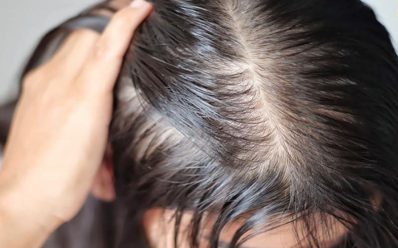 Tôi đã dùng thứ nước nhờn nhụa từ đậu bắp để ngăn tóc rụng Tôi đã dùng thứ nước nhờn nhụa từ đậu bắp để ngăn tóc rụng