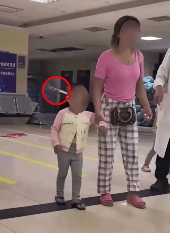 Bác sỹ kinh hãi khi bé gái 3 tuổi được mẹ dắt vào viện với con dao cắm vào đầu - Ảnh 1. Bác sỹ kinh hãi khi bé gái 3 tuổi được mẹ dắt vào viện với con dao cắm vào đầu - Ảnh 1.