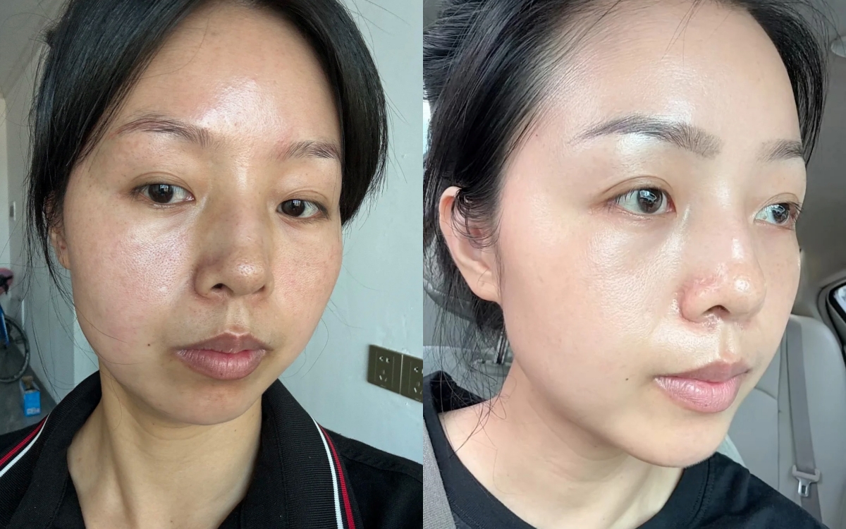 Blogger làm mờ thâm nám nhờ 2 năm tự dưỡng da kiên trì tại nhà - Ảnh 1.