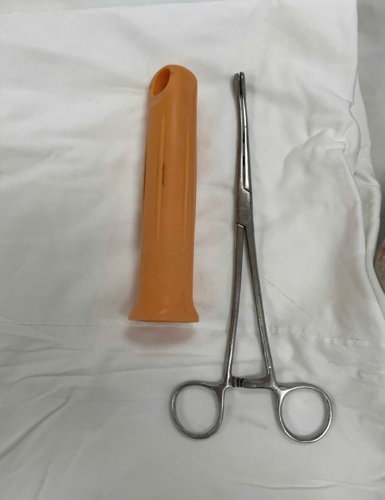 Cấp cứu nam thanh ni&ecirc;n 23 tuổi ở TP.HCM bị kẹt c&aacute;n c&acirc;y lau nh&agrave; khoảng 15cm trong hậu m&ocirc;n - Ảnh 2.