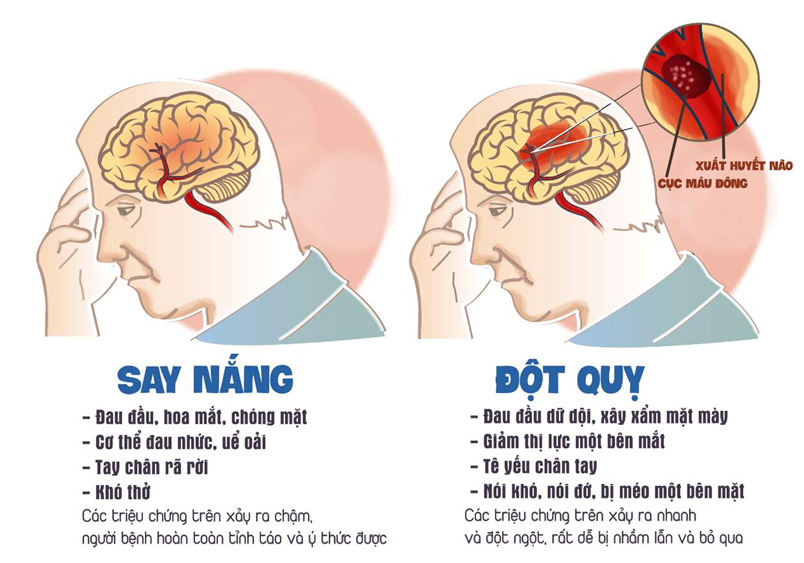 Bệnh viện Bạch Mai bác thông tin sai lệch &quot;cứ tăng 1 độ C thì nguy cơ đột quỵ tăng 10%&quot;: Cảnh báo mối nguy hiểm với 2 nhóm người- Ảnh 3.